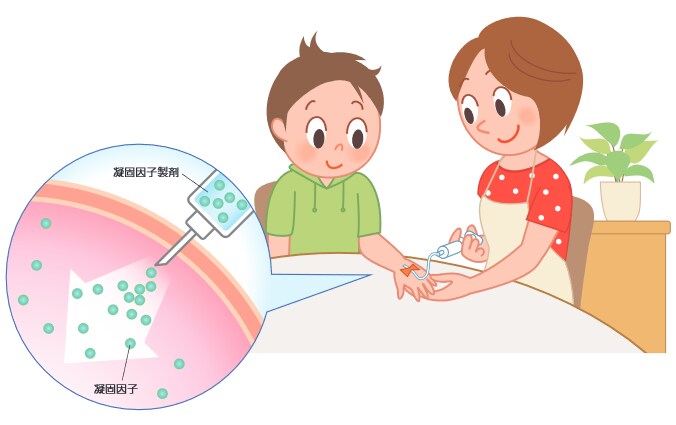 Title 血友病の治療は、不足している凝固因子を注射薬で補う「補充療法」が基本です