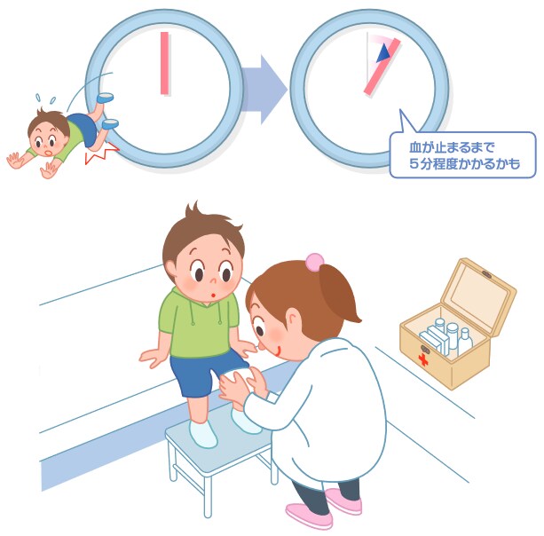 血友病とその原因