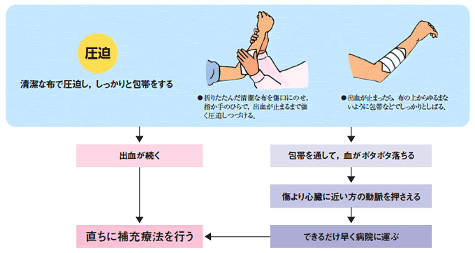 けがで出血した時は、どのように対処すればよいのでしょうか。