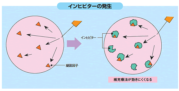 Title 凝固因子製剤は、いつまでも安心して使えるのでしょうか。