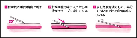 2.技術的な注意点 2.技術的な注意点