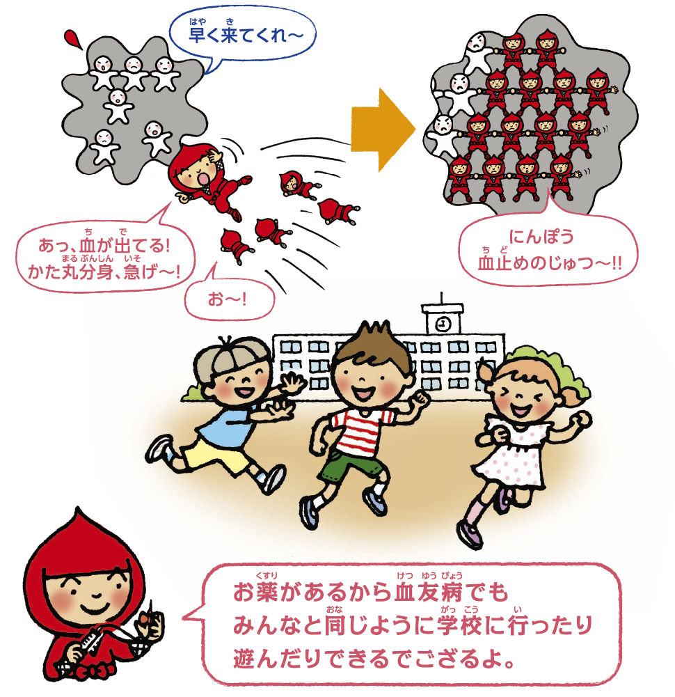 注しゃするとどうなるの？