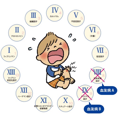 血友病とは