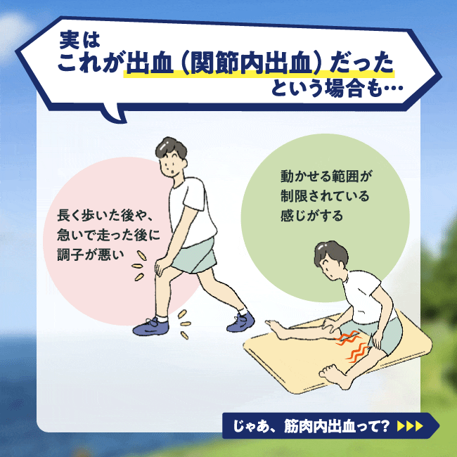 実はこれが出血(関節内出血)だったという場合も･･･