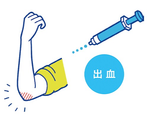出血時の注射（出血時補充療法）